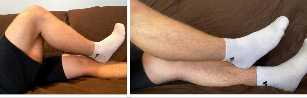 Photos showing two different positions for the heel to shin test