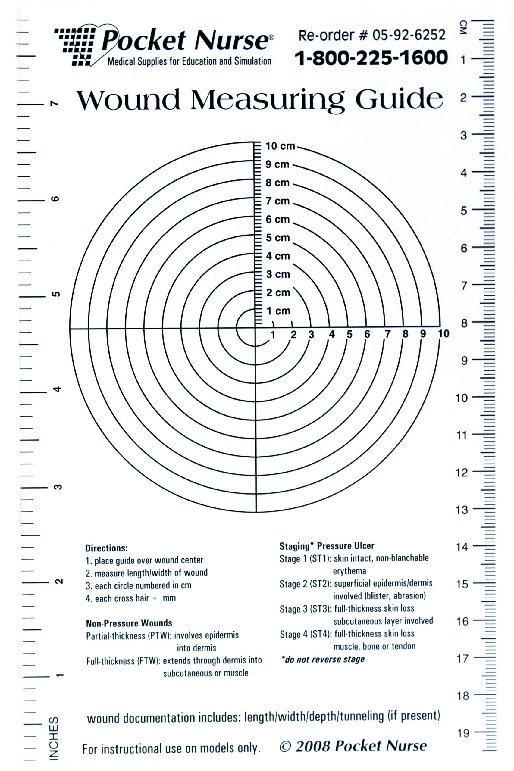 Photo showing a wound measurement tool