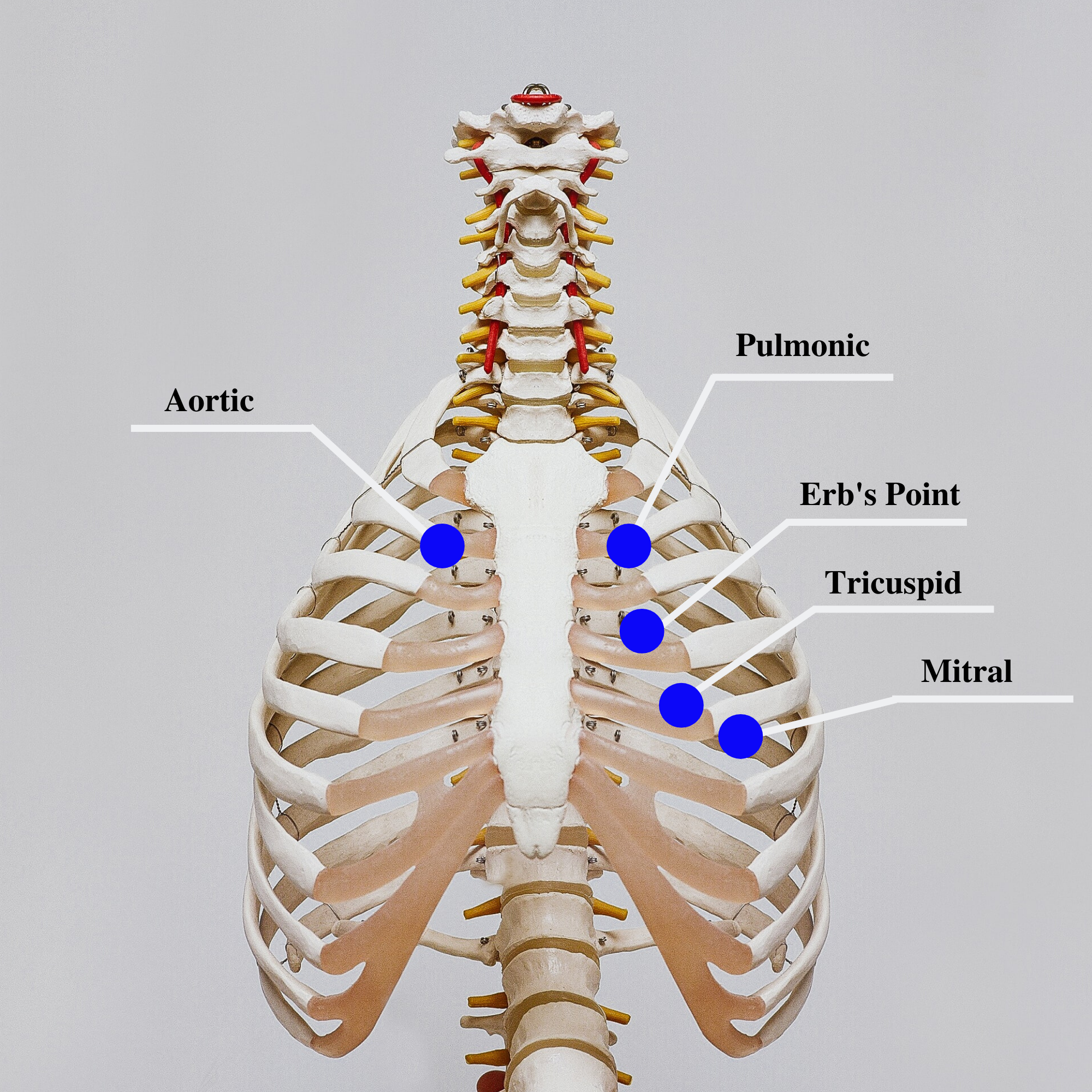 Image showing major precordial areas, with labels