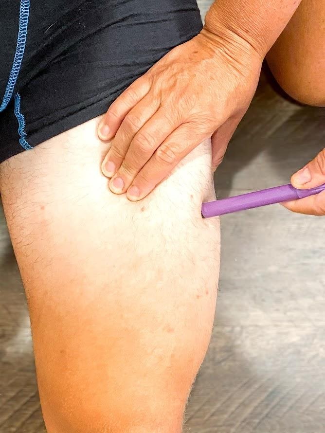 Photo showing Intramuscular Injection at Vastus Lateralis Site