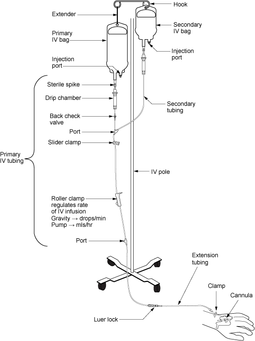 Illustration showing the Setup of Primary and Secondary Administration Sets, with textual labels