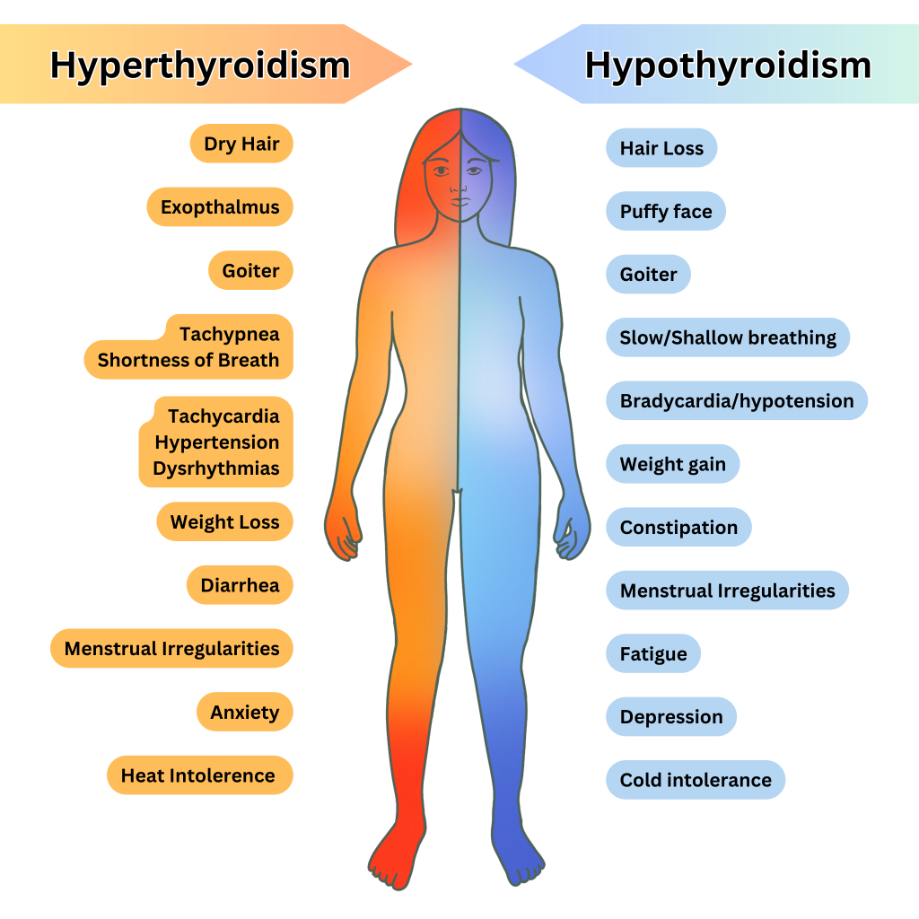 Infographic showing a Comparison of  the Clinical Manifestations of Hyperthyroidism and Hypothyroidism in an illustrated female figure. Includes textual labels for symptoms.