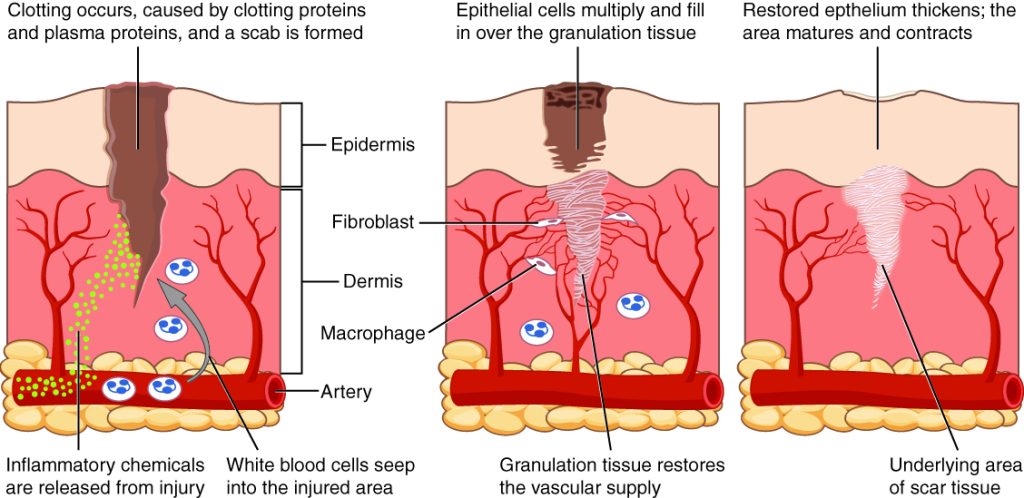 Illustration showing phases of wound healing, with labels