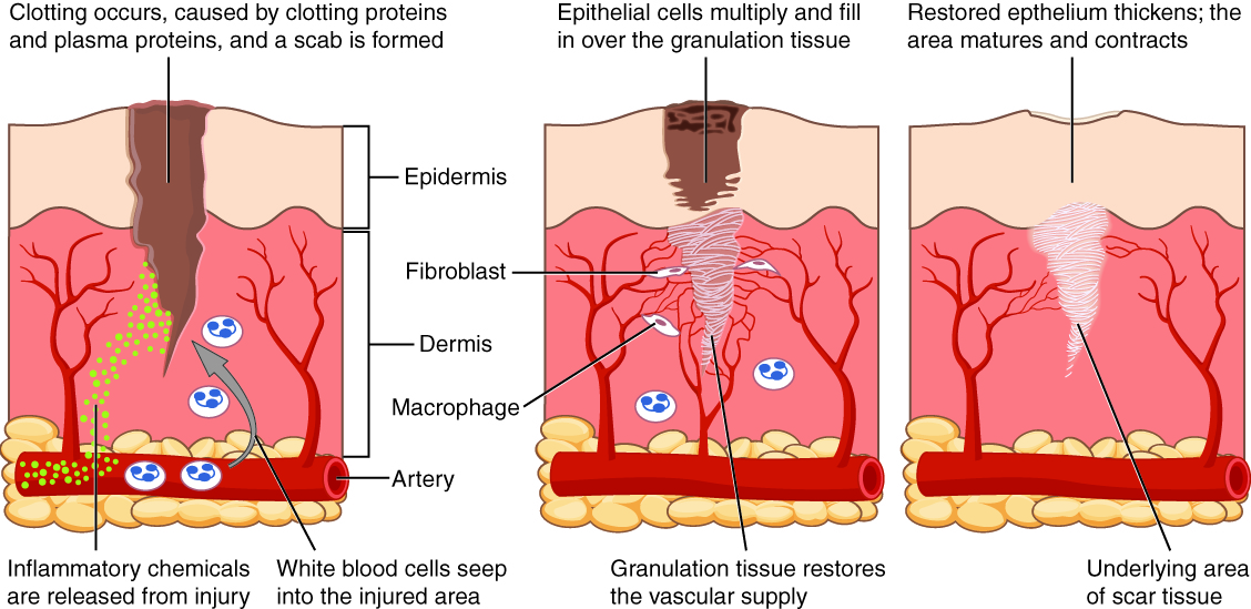 Image showing Phases of Wound Healing