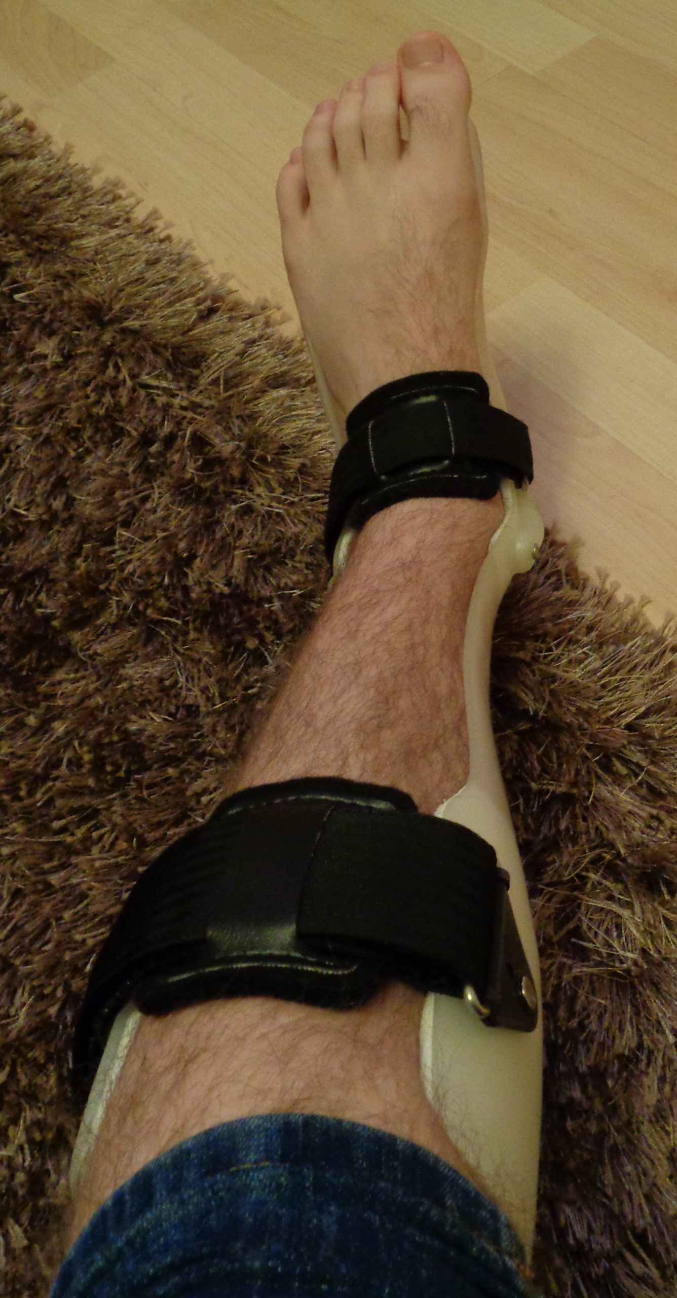 “AFO_Ankle_Foot_Orthosis_Orthotic_Brace.JPG” by Pagemaker787 is licensed under CC BY-SA 4.0 Image showing Brace to Prevent Foot Drop in use