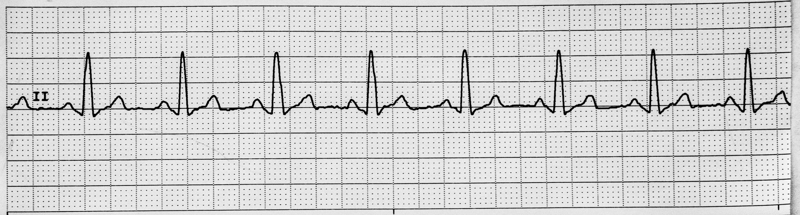 Image showing a normal ECG strip